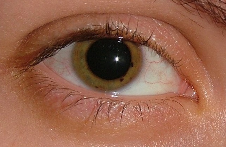 ojo-dilatado